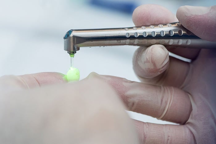 Dental professional using Waterlase laser technology during treatment