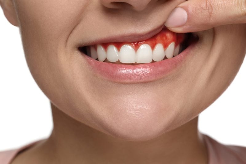 Close-up of healthy smile representing periodontal treatment and gum health